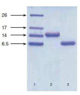 Western Blot: NT-proBNP Antibody (13G12cc) [NB120-14712]