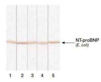 Western Blot: NT-proBNP Antibody (24E11cc) [NB120-13123]