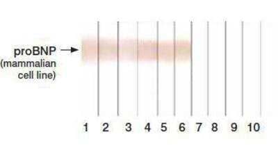 Western Blot: NT-proBNP Antibody (24E11cc) [NB120-13123]