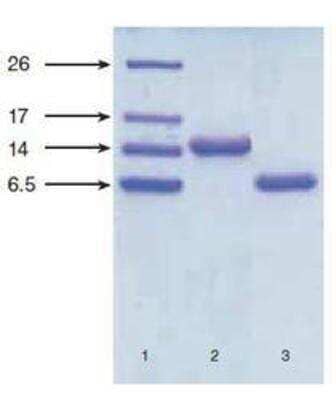 Western Blot: NT-proBNP Antibody (24E11cc) [NB120-13123]