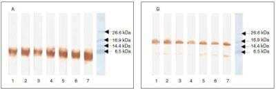 Western Blot: BNP Antibody (50E1cc) [NB200-440]