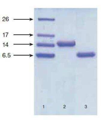 Western Blot: NT-proBNP Antibody (5B6cc) [NB120-13111]