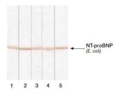 Western Blot: NT-proBNP Antibody (5B6cc) [NB120-13111]