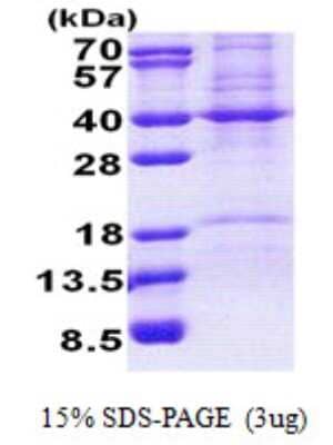 SDS-PAGE: Recombinant Human Prohibitin 2 His Protein [NBP2-23365]