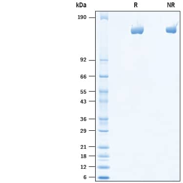 Recombinant Mouse Mrc2 His-tag Protein SDS-PAGE