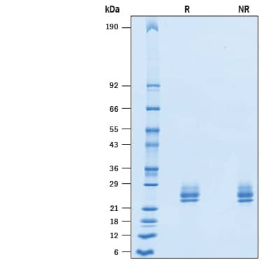Recombinant Cynomolgus Monkey IL-6 SDS-PAGE