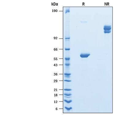 Recombinant Human Ly-6G6F Fc Chimera Protein SDS-PAGE
