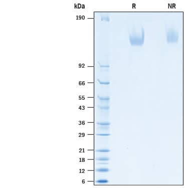 Recombinant Human MEGF9 His-tag Protein SDS-PAGE