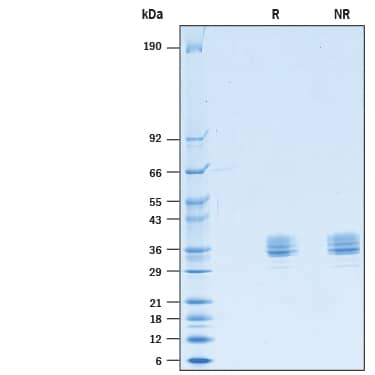 Recombinant Mouse Mesothelin (aa 36-288) His-tag Protein SDS-PAGE