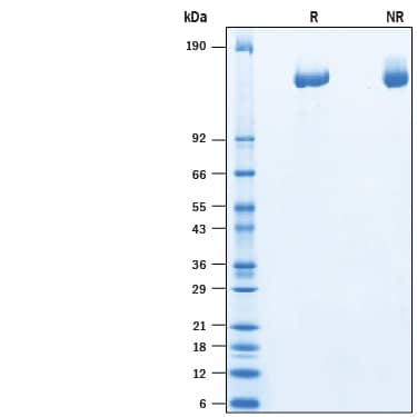 Recombinant Human Plexin A3 His-tag Protein SDS-PAGE