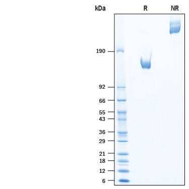 Recombinant Cynomolgus LIFR alpha Fc Chimera Protein SDS-PAGE