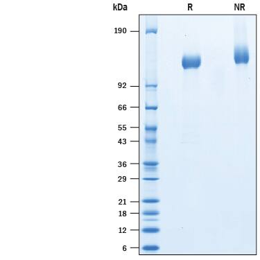 Recombinant Cynomolgus LIFR alpha His-tag Protein SDS-PAGE