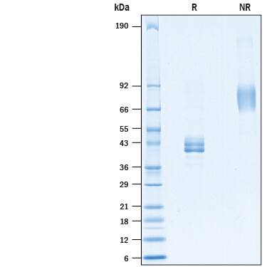 Recombinant Cynomolgus Monkey Ly6E Fc Chimera Protein SDS-PAGE