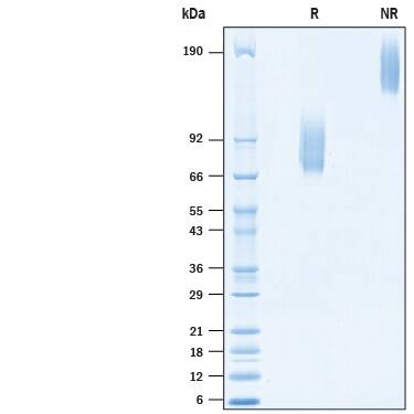 Recombinant Human IL-7R alpha/CD127 Fc Chimera Protein SDS-PAGE