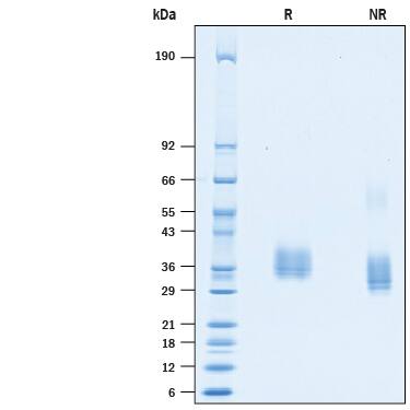 Recombinant SARS-CoV-2 Spike RBD His-tag Protein SDS-PAGE