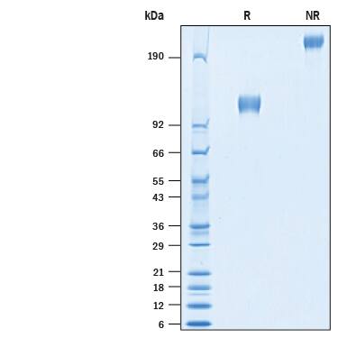 Recombinant Mouse LAMP-2/CD107b Fc Chimera Protein SDS-PAGE
