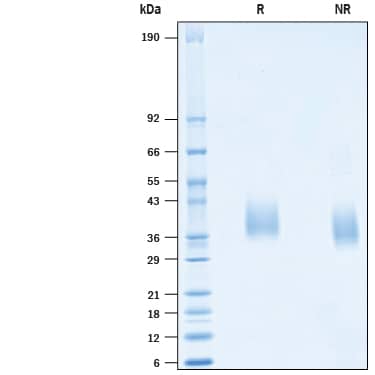 Recombinant SARS-CoV Spike RBD His-tag Protein SDS-PAGE