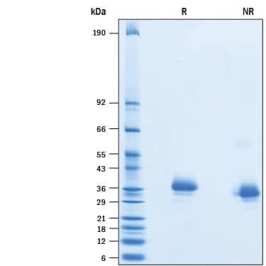 Recombinant SARS-CoV Spike RBD His-tag Protein SDS-PAGE