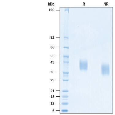 Recombinant BatCoV RaTG13 Spike RBD His-tag Protein SDS-PAGE