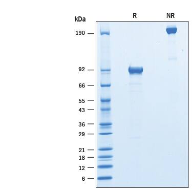 Recombinant Mouse NPRC/NPR3 Fc Chimera Protein SDS-PAGE