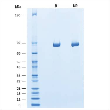 SDS-PAGE gel picture of purified Recombinant Human alpha-L-Iduronidase / IDUA Protein