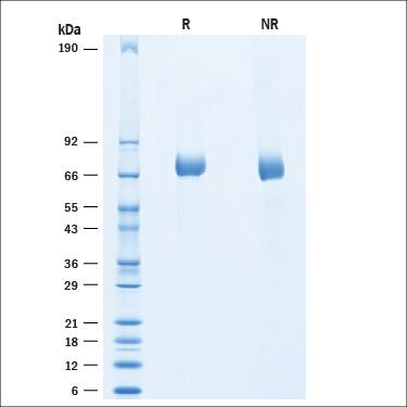 SDS-PAGE gel picture of purified Recombinant Human IL-4I1 Protein