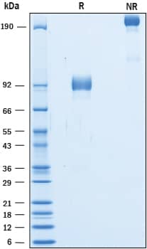 Recombinant Cynomolgus Monkey 5T4 Fc Chimera Protein SDS-PAGE