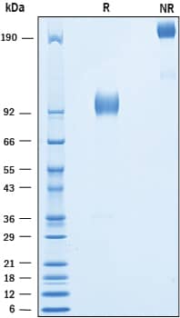 Recombinant Human 5T4 Fc Chimera Protein SDS-PAGE