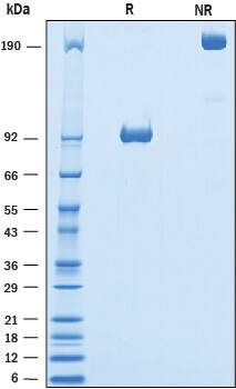 Recombinant Mouse 5T4 Fc Chimera Protein SDS-PAGE