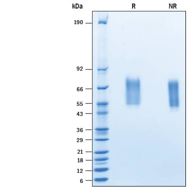 Recombinant Human 5T4 His-tag Avi-tag Protein SDS-PAGE