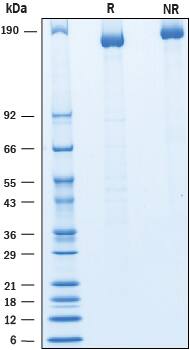 Recombinant Human ACLP His-tag Protein SDS-PAGE