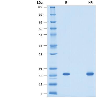 Recombinant Human AG-2/AGR2 His-tag Protein SDS-PAGE