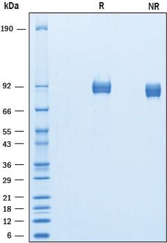 Recombinant Mouse ALCAM His-tag Protein SDS-PAGE
