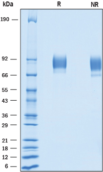 Recombinant Cynomolgus Monkey ALCAM His-tag Protein SDS-PAGE