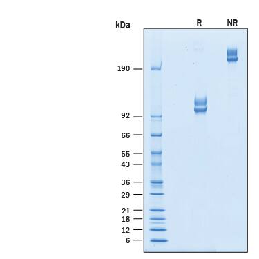 Recombinant Cynomolgus ALCAM/CD166 Fc Chimera Protein SDS-PAGE
