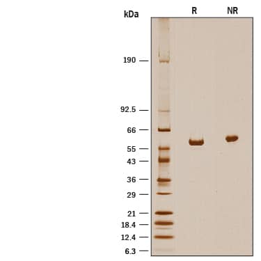 Recombinant Human ALDH1A2 His-tag SDS-PAGE