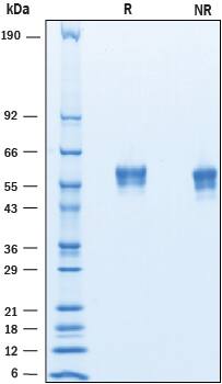 Recombinant Mouse AMIGO His-tag Protein SDS-PAGE