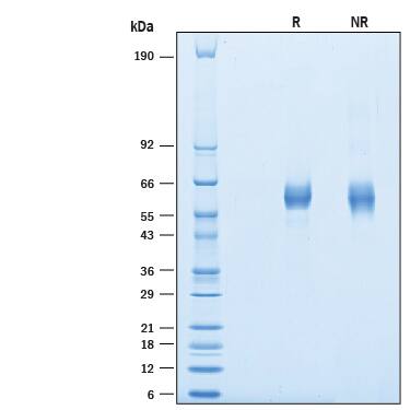Recombinant Human APCDD1 His-tag Protein SDS-PAGE