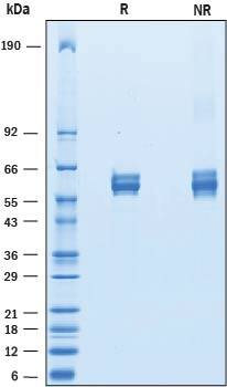 Recombinant Mouse APCDD1 Protein SDS-PAGE