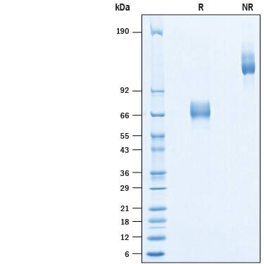 Recombinant Mouse ASGR2 Fc Chimera Protein SDS-PAGE