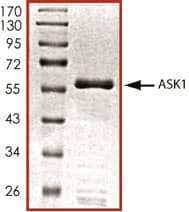 Recombinant Human Active ASK1 (aa 649-946) Protein SDS-PAGE