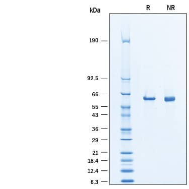 Recombinant Human Asparagine Synthetase/ASNS His Protein SDS-PAGE