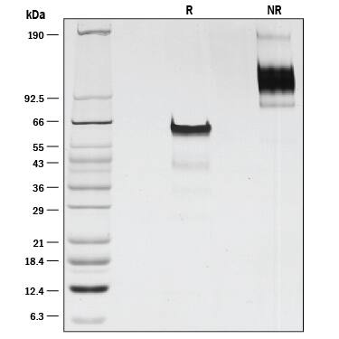 Recombinant Mouse Activin RIIB Fc Chimera Protein SDS-PAGE