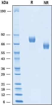 Recombinant Human Afamin His-tag Protein SDS-PAGE