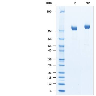 Recombinant Cynomolgus Aminopeptidase PILS/ARTS1 Protein SDS-PAGE