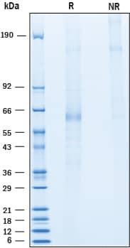 Recombinant Human Angiopoietin-like 1 Flag-tag Protein SDS-PAGE