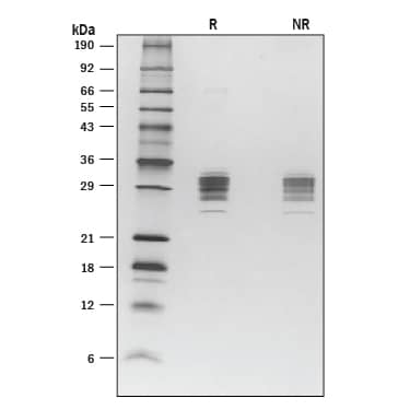 Recombinant Mouse Angiopoietin-like 3 (aa 17-220) SDS-PAGE