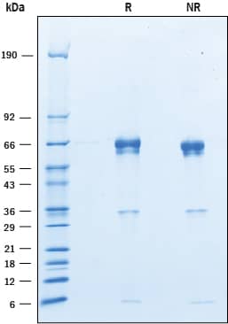 Recombinant Mouse Angiopoietin-like 3 (HA-Tag) Protein SDS-PAGE