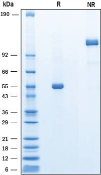 Recombinant Mouse ANGPTL8/Betatrophin Fc Chimera Protein SDS-PAGE