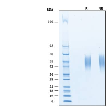 Recombinant Human B7-1/CD80 His-tag Avi-tag Protein SDS-PAGE